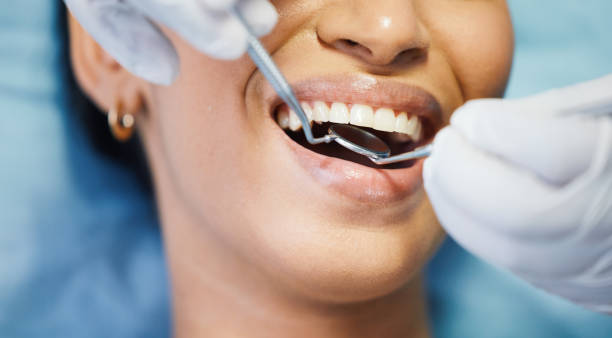 Best Emergency Wisdom Tooth Extraction in Sparta, MO