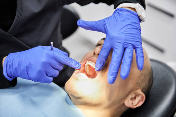 Best Emergency Treatment for Oral Infections in Sparta, MO